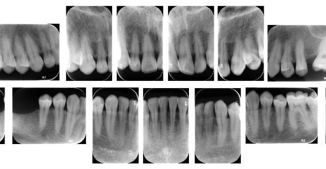 https://sitioprueba.io/wp-content/uploads/2022/05/Periapical-640x332.jpg